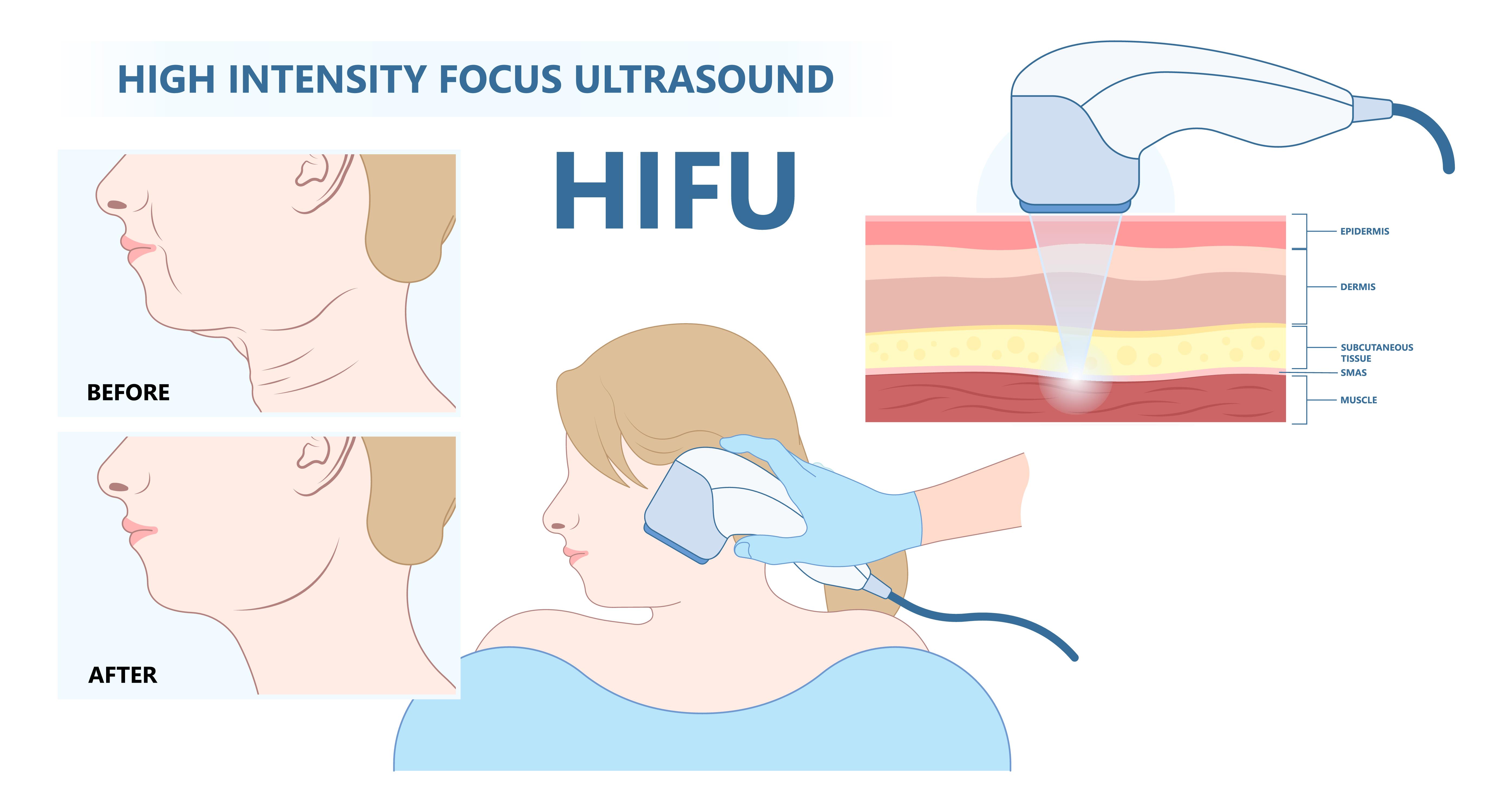 Best Skin Rejuvenation Treatment in Pune