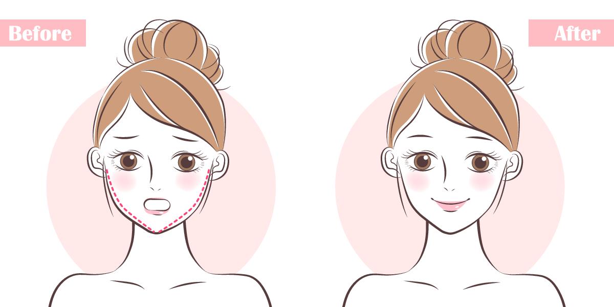 Best Chin Augmentation Surgeon in Pune