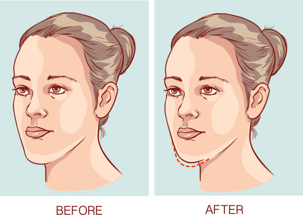 Best Chin Augmentation Surgeon in Pune