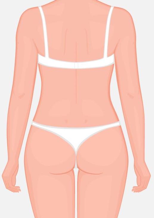 Best Stretch Marks Laser Treatment in Pune